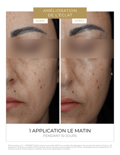 Vitamino C serumas C - POWDER FLASH | DERMEDEN | MISIJA ODA