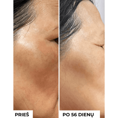 Koncentratas mažinti randelius ir pigmentaciją TXA 3% ANTI-DARK SPOTS CONCENTRATE