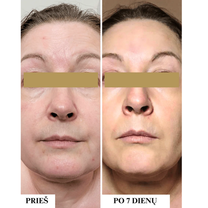 Sun protection cream for dry, sensitive skin SPF 50 
