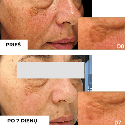 Intensive eye cream against wrinkles INTENSE EYE CONTOUR